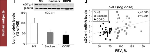 Figure 2 Resistive breathing (RB) in mice and the role of soluble guanylate cyclase.