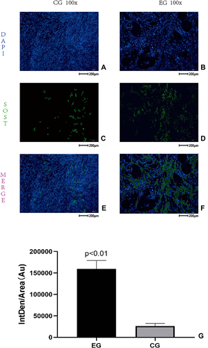 Figure 5 (A and B) The DAPI imaging of cell counterstaining. (C and D) The green fluorescence imaging of the sclerosteosis (SOST) gene in cells. (E and F) The MERGE imaging of cell immunofluorescence. (G) The plot of the SOST expression measurement.