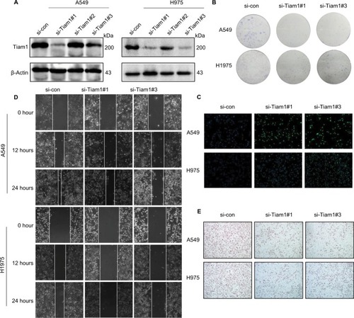 Figure 4 Tiam1 depletion reduces cancer cell proliferation, colonization, and migration capacities.Notes: (A) Tiam1 protein expression was inhibited by Tiam1-specific siRNAs in A549 and H1975 cancer cell lines, compared with si-control, as verified by Western blot analysis. (B) Colony formation assay of A549 and H1975 cancer cell lines. (C) CFSE incorporation for evaluation of proliferation capacities of A549 and H1975 cancer cell lines (original magnification, 100×). (D) Wound healing assay to detect the effects of si-Tiam1 on A549 and H1975 cancer cell motilities. (E) Transwell migration assay of si-Tiam1 cells in both A549 and H1975 cancer cell lines (original magnification, 100×).Abbreviation: CFSE, carboxyfluorescein diacetate succinimidyl ester.