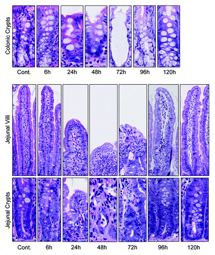 Figure 2. Irinotecan administration causes severe histological damage in the jejunum and colon of DA rats. Characteristic apoptotic bodies are visible at 6 and 96 h post-irinotecan. Gross architectural changes (villous blunting and crypt degeneration) are evident at 24 h, but are most severe at 48 and 72 h hours. Restoration of the epithelium is evident at 120 h, indicated by mitotically active cells. Original magnification 200× (villus) and 400× (crypt).