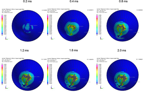Figure 15 Sequential strain strength response of ocular surface of model eye upon airbag impact in straight position at 40 m/s with adhesion strength of scleral flap of 50%, shown at 0.4-ms intervals after 0.2 ms. Strain strength change is displayed in color as presented in the color bar scale (Figure 2).