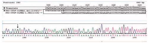 Figure 4. Sequencing analysis of recombinant PRS-CTGF-siRNA retrovirus plasmid.