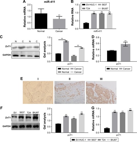 Figure 1 Expression of miR-411 and ZnT1 in bladder cancer.