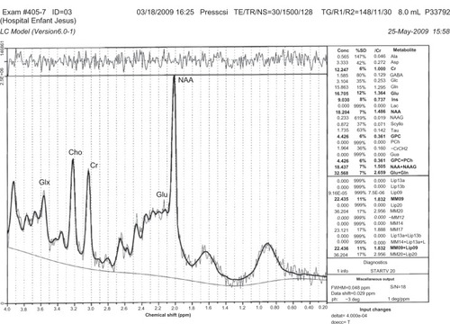Figure 4 Example of SRM spectra.