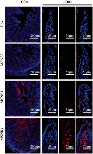 Figure 4. LSCM images of Dox absorption at intestinal tissue with DAPI used to stain cell nucleus.
