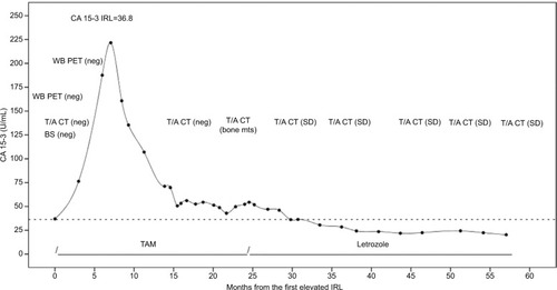 Figure 2 Serum CA 15-3 behavior during postoperative follow-up of patient 2.Abbreviations: BS, bone scintigraphy; CT, computed tomography; IRL, individual reference limit; mts, metastases; neg, negative; PET: positron emission tomography; SD, stable disease; T/A, thoracic/abdominal; TAM, tamoxifen; WB, whole body.