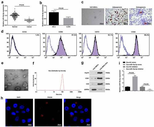 Figure 1. miR-15a-5p is downregulated in WT. A. RT-qPCR tested miR-15a-5p expression in WT tissues and normal tissues; B. RT-qPCR tested miR-15a-5p expression in normal renal tubular epithelial HK-2 cell line and human WT G-401 cells; C. Microscopic observation of hUC-MSCs, and staining of adipocytes and osteoblasts; D. Flow cytometry tested hUC-MSCs surface markers; E. TEM observation of hUC-MSCs-Exo; F. NTA detection of hUC-MSCs-Exo; G. Western blot tested HSP70, CD81, CD9 and GRP94 in hUC-MSCs-Exo; H. Internalization of PKH26-labeled exosomes (red) in G-401 cells; I. RT-qPCR tested miR-15a-5p expression in hUC-MSCs-Exo. Measurement data were shown by the mean ± standard deviation.