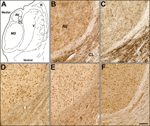Figure 2.  Histochemical staining of human brain tissue at the level of the thalamus in the coronal plane. (A) Parcellation of the thalamus in the region used to compare histochemical staining by various cholinesterase substrates; (B) Acetylthiocholine. (C) (N-methylpiperidin-4-yl) ethanethioate. Note that both of these substrates produced a similar pattern of staining recapitulating the known distribution of acetylcholinesterase in this region. (D) Butyrylthiocholine. (E) (N-methylpiperidin-4-yl) butanethioate. (F) (N-methylpiperidin-4-yl) 4-cyanobenzenecarbothioate. Note that these substrates produced a similar pattern of distribution that reflected the known distribution of butyrylcholinesterase in this region. AV: anteroventral nucleus; CL: central lateral nucleus; MD: mediodorsal nucleus; R: reticular nucleus; V: ventral nuclei. Scale bar = 200 µm.
