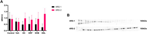 Figure 3 Protein expression of total IRS-1 and IRS-2. (A) Ratio of IRS1 to IRS 2, (B) probed blot. n=4–5.