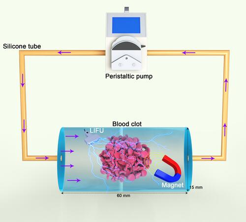 Figure 2 Schematic diagram of the extracorporeal circulation device.