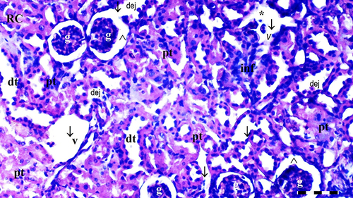 Figure 10 Representative light microscopy of kidney tissue from the DIR-FC60 group. Scale bar 50 µm, H&Ex100.