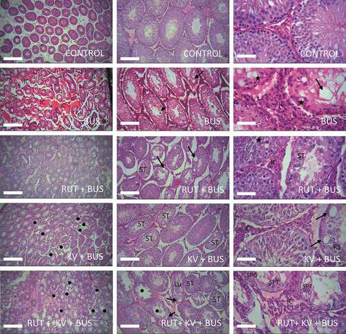 Figure 4. Histopathological examinations of testes isolated from the studied experimental animals. The testes of the control animals showed germ cells that have normal shapes and are seen to be at different stages of maturation in tubules with a centrally located lumen as expected. Many of these cells are seen in layers arising from the basement membrane. As expected, the testes of busulfan (BUS) treated animals have smaller tubules with lots of empty (vacuolar) spaces (long arrows) in the seminiferous epithelium, wide interstitial spaces amongst neighboring tubules and giant apoptotic cells (short arrow) at the luminal border. Note the large populations of interstitial cells between neighboring tubules (IC) along with germ cells (starred) at the basement membrane with abnormal shapes. Spermatids e.g., round spermatids are completely absent in many of the tubules. The tubules had improved morphology similar to the control in the rutin (RUT) + BUS group of animals and better than BUS-treated animals, although there are still few cells within the vacuolated epithelium (arrows) that are somewhat degenerated and with the presence of apoptotic cells (starred). The testes of the kolaviron (KV) + BUS treated animals have few damaged tubules (black dots). Some of the tubular epithelium appeared degenerated (ST) and contain giant vacuoles (arrows) and few round spermatids (RS). The wide intertubular spaces (IC) were seen to contain interstitial cells e.g., Leydig cells. There are more damaged tubules (black dots) with degenerated epithelium (ST), presence of vacuoles (arrows) and defoliated cells in the lumen (Lu) of the KV + RUT + BUS treated animals. The spaces between neighboring tubules are still wide (IC) and few germ cells e.g., spermatocytes (SPT) and spermatogonia (SPG) can still be observed in some tubules. Mag: (4×: Left panel; 10 ×: middle panel; 40 × right panel). Scale bars = 100 µm