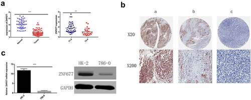 Figure 2. Expression of ZNF677 in ccRCC samples and normal tissues and 786–0 cells. (a) The relative expression levels of ZNF677 mRNA in 60 ccRCC tissues and 47 normal tissues were determined by qRT-PCR. (b) The relative expression levels of ZNF677 proteins in 60 ccRCC tissues and 47 normal tissues were measured by IHC. ZNF677 protein levels were found to be downregulated in cancer tissues in comparison to normal tissues. Moreover, the expression of the ZNF677 protein was gradually decreased in the primary tumor and metastatic tissues: (a) normal tissue, (b) non-metastatic cancer tissue, (c) metastatic cancer tissue. (C) The relative expression level of ZNF677 mRNA and protein in the ccRCC 786–0 cell line was clearly decreased compared with the immortalized human proximal tubular cell line HK-2 cells evaluated by qPCR and Western blot.