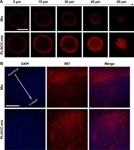 Figure 5 Enhanced drug penetration of PL/ACC-MIT nanoparticles in tumor tissue.Notes: (A) In vitro penetration of MIT into the MCTS after incubation with free MIT or PL/ACC-MIT nanoparticles for 24 hours. (B) In vivo penetration of nanoparticles into the tumor tissue after intratumoral injection of free MIT or PL/ACC-MIT nanoparticles for 24 hours. The frozen tumor sections were observed from the top (injection site) of the tumor to the middle using CLSM. The nuclei were stained by DAPI (blue). Scale bar: 200 µm.Abbreviations: ACC, amorphous calcium carbonate; CLSM, confocal laser scanning microscopy; MCTS, multicellular tumor spheroid; MIT, mitoxantrone; PL, phospholipid.