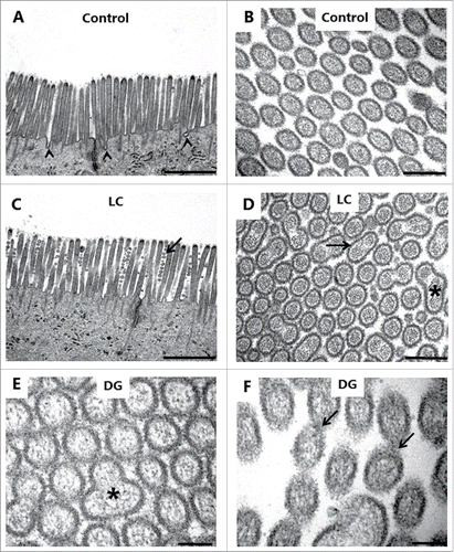 Figure 7. PE action on the enterocyte brush border. Electron micrographs of the microvillus membrane from mucosal explants cultured for 1 h in the absence (A, B) or presence of 2 mM LC (C, D) or 2 mM DG (E, F). A, C: Longitudinal sections of microvilli. Only in the control were membrane invaginations frequently seen between adjacent microvilli (arrowheads), implying an ongoing endocytosis. LC induced sporadic microvesiculation of microvilli (arrow). B, D-E: Cross sections of microvilli. LC and DG disrupted the hexagonal order by inducing widespread pair-wise fusion of microvilli (arrow), and occasionally 3 fused microvilli of various shapes were also seen (asterisks). F: Cross section of microvilli at high magnification. Arrows indicate pairs of microvilli connected by a “stalk," possibly in the early stage of fusion. The images shown of each situation are representative of at least 5 images. Bars: 1 µm (A, C); 0.2 µm (B, D); 0.1 µm (E, F).