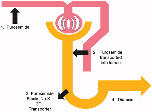 Figure 2. Testing of renal tubular integrity with the furosemide stress test in early AKI. In order for a brisk urinary response to furosemide there are four components that must be achieved. 1. Furosemide enters the blood stream and then must bind to albumin. 2. Active secretion by proximal tubular from the basolateral membrane to the lumen by the hOAT system. 3.Transport of the furosemide in the lumen dissolved in the glomerular filtrate transported to the TAL and binding to the Na- K-2Cl apical transporter. 4. Resultant diuresis.