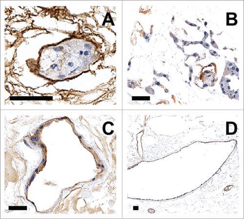 Figure 5. (A) Collagen IV immunohistochemical staining of glomerular tuft containing EOMA cells. (B–D) CD31 immunohistochemical staining of EOMA cells lining blood vessels. Scale bar = 50 μM.