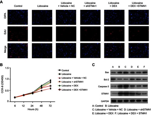 Figure S2 DEX depresses the expression of STMN1 induced by lidocaine in primary neuronal cells. (A) The effect of STMN1 knockdown and overexpression on cell proliferation in lidocaine or lidocaine/DEX combination treated cells was detected by EdU-staining assay. (B) The effect of STMN1 knockdown and overexpression on cell viability in lidocaine or lidocaine/DEX combination treated cells was detected by CCK8 assay. NC means co-transfection of scramble shRNA and pcDNA3.0 vector. (C) The expression of Bax, Bcl-2, caspase-3 and caspase-9 was analyzed by Western blotting. The experiments were performed in triplicate.