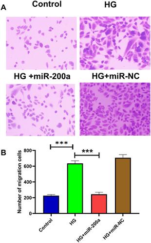 Figure 6 Effects of miR-200a on cell migration in high glucose (HG)-treated HRMECs. The migrated cell rate was detected in cultured HRMECs in (A) normal glucose (NG), high glucose (HG), HG+miR-200a and HG+miR-NC; (B) summary of apoptotic rates in different groups. HG treatment significantly increased apoptotic rate, while the apoptotic status was improved by miR-200a treatment. ***P<0.001. n = 5.