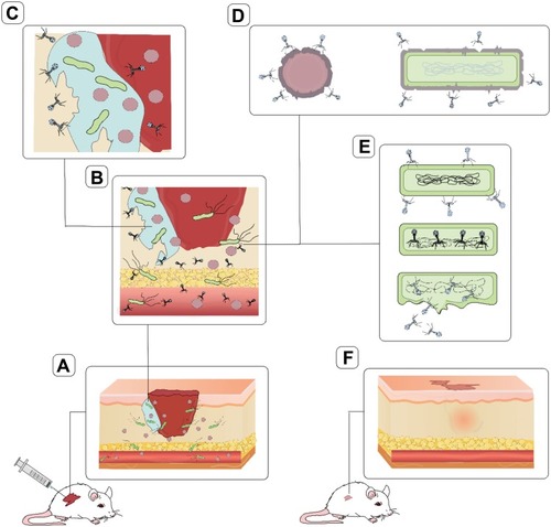 Figure 1 Different mechanisms of phage therapy for the prevention of wound infections. (A) Bacterial pathogens colonize the wound. (B) Bacteriophages inhibit septicemia caused by bacterial pathogens. (C) Bacterial biofilm created in the wound, one of the main reasons for antibiotic resistance, is destroyed by bacteriophages. (D) Bacteriophages reduce the invasive properties of bacteria by destroying bacterial virulence factors such as capsules. (E) Bacteriophages destroy their hosts and inhibit wound infections. (F) Accelerating the process of wound healing has been reported as one of the consequences of using bacteriophages in different wounds.