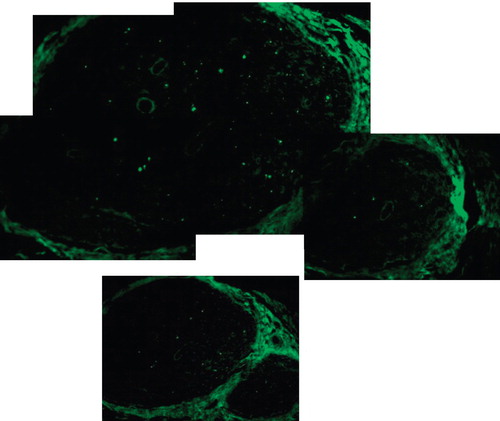 Figure 4. The GFP stained cells of the sciatic nerve in group D, the GFP transplantation model, at the point of 5 mm distal from suture. Cold preservation time 0 hour, at two weeks after transplantation. 489-nm wave length excitation light (original magnification ×40).