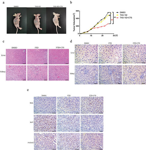 Figure 6. The combination of FTD and CTS inhibits HGC-27 xenograft tumor growth in vivo. HGC-27 cells (4 × 107) were injected subcutaneously into the nude mice to establish a tumor xenograft model. The nude mice were administered TAS-102 (75 mg/kg, i.p., twice a day) alone or in combination with CTS (10 mg/kg, p.o., every 2 days) for 2 weeks, and the control group received intraperitoneal injection of an equal dose of DMSO every 2 days. (a) Representative nude mice xenograft tumor images of DMSO group, TAS-102 group and TAS-102+CTS group. (b) Tumor volume changes were monitored every 3 days. Data were expressed as mean ± SD, n = 3. After treatment with DMSO, TAS-102 and CTS for 2 weeks, the liver and kidney showed no significant inflammation by HE staining (c), and the expression of inflammatory cytokine IL-6 was further detected by immunohistochemistry (d). We used BrdU antibody to detect the amount of FTD in the xenograft tumor tissue in the three treatment groups using immunohistochemistry. Ki-67 and p-STAT3 were used to detect the malignant degree and phosphorylation level of STAT3 in each group of xenograft tumors, respectively (e). HE staining (high power field, ×200) and immunohistochemistry (high power field, ×400).