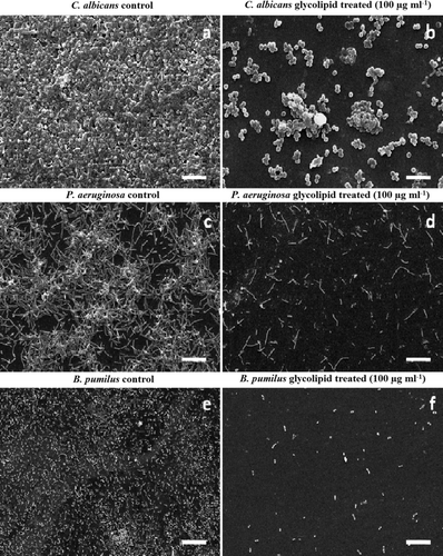 Figure 6. Representative SEM images of preformed biofilms of C. albicans, P. aeruginosa and B. pumilus. Control (a, c and e); treated with 100 μg ml−1 glycolipid biosurfactant after 24 h (b, d, f). The scale bar represents 10 μm for a and b and 5 μm for c to f.