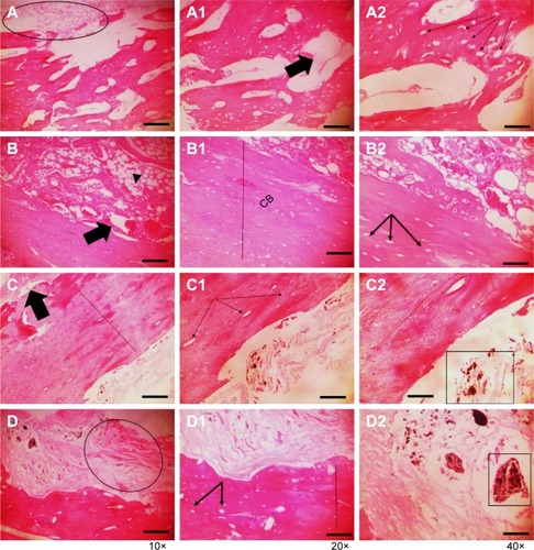 Figure 3 Optical microscopy photographs of the rat tibias from the control group and after 21 days from the implantation: G1 (A, A1, and A2), G2 (B, B1, and B2), G3 (C, C1, and C2), and G6 (D, D1, and D2). H&E: 10, 20, and 40×, respectively. Scale bar of 200 µm. Periosteum (circle), trabecular bone (➔), osteocytes (→), bone marrow (▲), and nHAp/GNR (square).Abbreviations: CB, compact bone; H&E, hematoxylin and eosin; nHAp/GNR, nHAp and GNR composites.