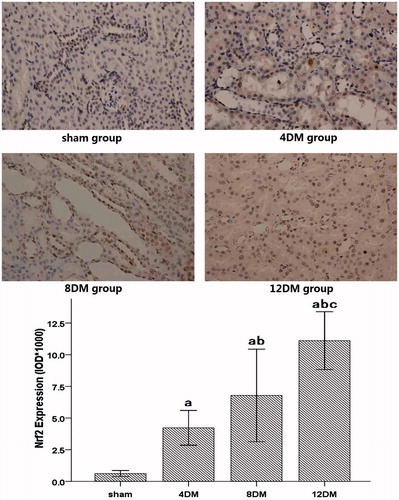 Figure 7. Expression of Nrf2 in renal tissues assessed by immunohistochemistry (SP ×400). Values (mean ± SD) were obtained for each group of eight animals. ap < 0.05 compared to the values of normal rats (sham). bp, cp < 0.05 compared to the values of diabetic rats after 4 weeks and 8 weeks (4DM, 8DM), respectively.