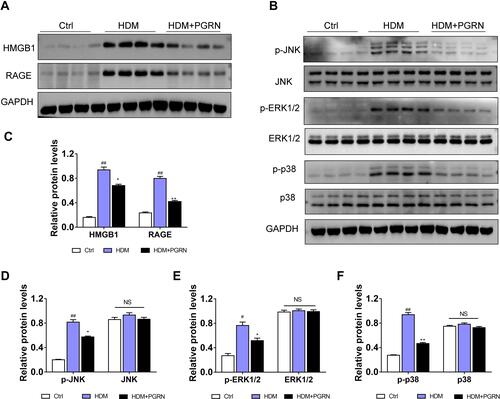 Figure 5 Effect of PGRN on HMGB1, RAGE and MAPK pathways in HDM-challenged mice. (A) PGRN downregulated HMGB1 and RAGE protein expression in mice lungs upon HDM exposure. (B) The effect of PGRN on phosphorylated and total JNK, ERK1/2, and p38 expression were evaluated by immunoblotting analysis. (C–F) Quantitative densitometric ratio of the above proteins normalized to GAPDH in each group. For immunoblotting analysis, data are expressed as means±SEM of three independent experiments with four mice per group. #p<0.05 vs control group, ##p<0.01 vs control group, *p<0.05 vs HDM group, **p<0.01 vs HDM group.