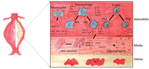 Figure 1. Immune cells in abdominal aortic aneurysm formation. Different immune-inflammatory responses occur at varying levels of AAA wall. Adventitia: Macrophages are mainly polarized to pro-inflammatory M1 in AAA wall. Polarization of CD4+ Th cells and their cytokines can influence macrophage polarization. Neutrophils are recruited early in inflammation and increase over time. Media: Inflammatory cytokines secreted by above cells will promote smooth muscle cell (SMC) apoptosis and ECM degradation. Intima: Most aneurysms possess intraluminal thrombus (ILT), which is related to AAA size, growth, and rupture.