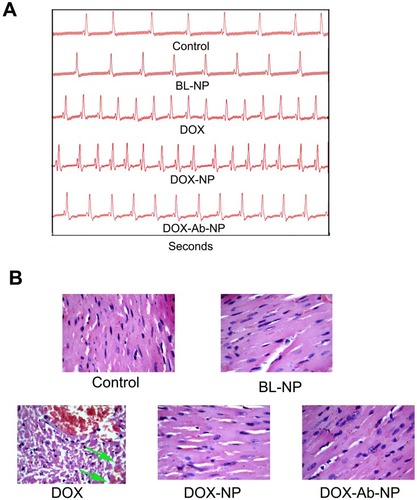 Figure 9 Comparative cardiotoxicity profiles by the treatment of DOX, BL-NP, DOX-NP, and DOX-Ab-NP.Notes: (A) Echocardiography images. (B) Histopathology of cardiac tissue (Vascularization due to free-drug treatment was shown by the green arrow in the respective image).Abbreviations: DOX, doxorubicin; Ab, antibody; NP, nanoparticle.