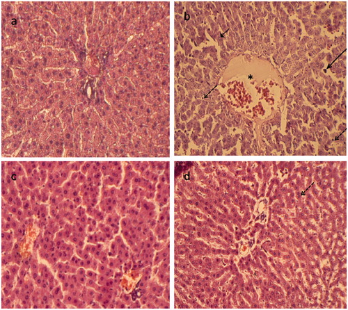 Figure 4. Paraffin sections stained by haematoxylin and eosin (H&E) for histopathological examination of liver tissues of rats as follows: (a) the control rats; (b) rats treated with lead (500 mg Pb/L in the drinking water); (c) rats fed with carnosine (10 mg/kg, i.g.) and (d) rats treated with lead (500 mg Pb/L in the drinking water) and fed with carnosine (10 mg/kg, i.g.). The long arrow indicates infiltrating leukocyte. The short arrow indicates pyknotic nucleus. The dashed arrow indicates hepatic cell necrosis. The asterisk indicates the distended portal vein.