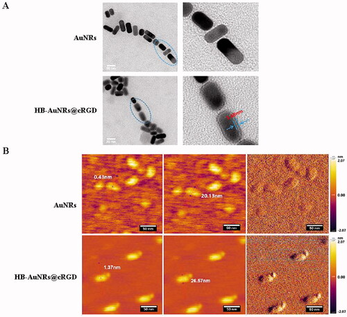 Figure 3. TEM and AFM images of HB-AuNRs@cRGD. (A) TEM and (B) AFM images of AuNRs and HB-AuNRs@cRGD.