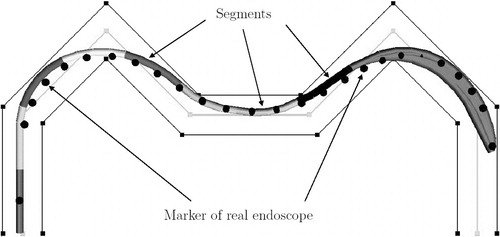 Figure 15 Final result (n=44, n′=20, k=4, p=7), showing only the first k=4 links of each tentacle. For the last segment the energy constraint has been relaxed by computing the p=7 smallest energies. The endoscope model largely matches the measured markers of the real endoscope. [Color version available online]