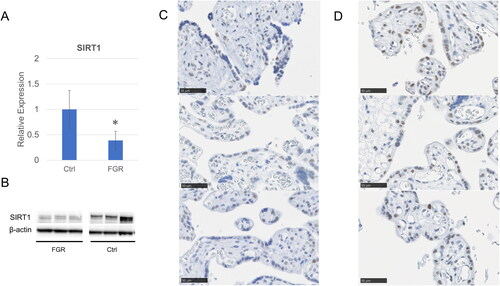 Figure 1. Downregulation of SIRT1 expression in full-term fetal growth restriction (FGR) placentas. (a) the mRNA and (b–d) protein expression levels of sirtuin 1 (SIRT1) were analyzed using (a) reverse transcription-quantitative polymerase chain reaction (RT-qPCR), (b) western blotting, and (c) immunohistochemical analysis of full-term FGR placental tissues and (d) full-term normal delivery or cesarean (C-) section placental tissues. Data are presented as the mean ± standard error of the mean (SEM). Asterisks (*) indicate statistical significance as compared with the control (p < .05). Ctrl: control placenta; FGR: fetal growth restriction; SIRT1: sirtuin 1.