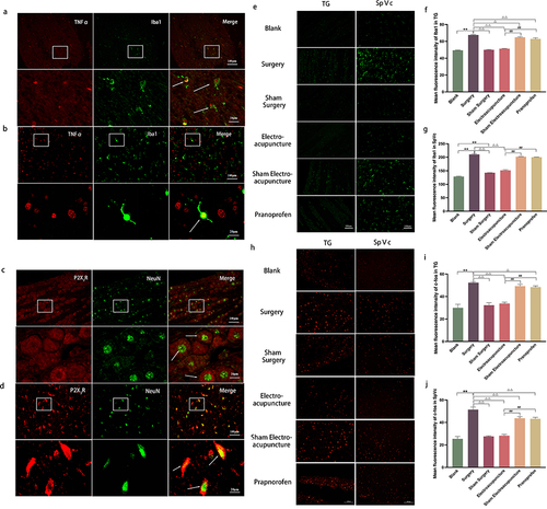 Figure 3 (a and b) Co-localization of TNF-α (red) with Iba1 (green) in TG and SpVc observed through immunohistochemical fluorescence; Activation of Iba1 was observed, with an increase in microglia cell body and shorter protuberance; The morphology of microglia became round or rod-shaped. The cells marked by the white arrow indicate cells where TNF-α co-localizes with Iba1; (c and d) Co-localization of P2X3R (red) and NeuN (green) in TG and SpVc observed through immunohistochemical fluorescence; P2X3R was widely expressed on neurons; The cells marked by the white arrow represent the co-localized cells of P2X3R and NeuN; The enlarged images correspond to the magnified views of the cells in the a-d diagrams, respectively; Scale bar = 100 μm; Enlarged image scale bar = 20 μm. (e and h) Immunohistochemical fluorescence of Iba1/c-fos in TG and SpVc of rats in each group; Scale bar = 100 μm. (f and i) Histogram of the average fluorescence intensity of Iba1/c-fos in the TG of rats in each group. (g and j) Histogram of the average fluorescence intensity of Iba1/c-fos in SpVc of rats in each group. Data are expressed as mean ± standard error, n=3. *P<0.05, **P<0.01 versus blank group; ΔP<0.05, ΔΔP<0.01 versus surgery group; #P<0.05, ##P<0.01 versus EA group.
