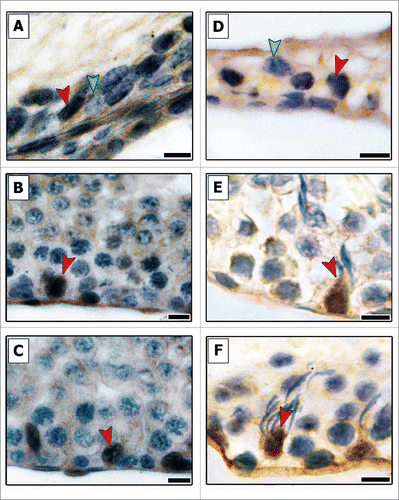 Figure 4. Evaluation of p27 immunostaining in different areas of testicular parenchyma in pre-pubertal (A–C) and adult (D–F) Wistar rats. The transition region (TR) (A and D), the area adjacent to the transition region (B and E) and along the seminiferous tubules (C and F) were investigated for this cell-cycle inhibitor. All Sertoli cells present in Cx and ST were positive for p27 (red arrowheads, B–F), whereas negative Sertoli cells (green arrowheads) were observed only in the TR. Bars: 10 μm.