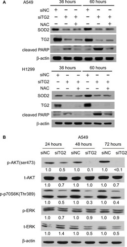 Figure 6 TG2 associated with SOD2 expression and AKT/mammalian target of rapamycin/p70S6K signaling pathway activation.Notes: (A) Western blot analysis of the association of SOD2 with TG2 expression with or without N-acetyl-L-cysteine after 36 and 60 hours of siRNA transfection on A549 and H1299 cells. (B) Western blot analysis of the AKT/mTOR/p70S6K signaling pathway on A549 cells after 24, 48, and 72 hours of siRNA transfection.Abbreviations: SOD2, superoxide dismutase 2; TG2, tissue transglutaminase 2.
