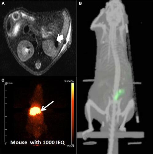 Figure 1 Islets transplantation imaging of MRI, SPECT and PET. (A) In vivo MR imaging of recipients having transplanted islets. In vivo spin echo T2-weighted axial MR images of heparin-SPIO-conjugated islets 30 days after xenotransplantation under the renal subcapsular membrane of left kidney in nude mice (300 islet equivalent/mouse). The dark area in the left kidney represents a labeled islet graft. Arrow: transplantation site. Reprinted from Biomaterials. 32(35). Jung MJ, Lee SS, Hwang YH, et al.MRI of transplanted surface-labeled pancreatic islets with heparinized superparamagnetic iron oxide nanoparticles. 9391–9400, Copyright (2011), with permission from Elsevier.Citation21 (B) Transplanted islets under the left kidney capsule of CD1 mice labeled by 111In-tropolone was imaged by three-dimensional reconstructions SPECT/CT. This research was originally published in J Nucl Med. Tai JH, Nguyen B, Wells RG, et al. Imaging of gene expression in live pancreatic islet cell lines using dual-isotope SPECT. J Nucl Med. 2007;49(1):94–102. ©SNMMI. http://jnm.snmjournals.org/content/49/1/94.short.Citation39 (C) PET images were obtained after the [68Ga]DO3A-VS-Cys40-Exendin-4 intravenous injections via the tail in NOD/SCID mice with human-transplanted islets in the liver. The liver with transplanted islets demonstrate prominent tracer uptake (arrow). Reproduced from Junfeng L, Rawson J, et al. Evaluation of [68Ga]DO3A-VSCys40- exendin-4 as a PET probe for imaging human transplanted islets in the liver. Sci Rep. 2019;9:5705. Creative Commons license and disclaimer available from: http://creativecommons.org/licenses/by/4.0/legalcode.Citation56