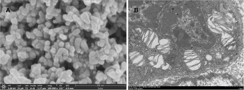 Figure 2 The characterization of the Nano-ITO. (A) The SEM images of the Nano-ITO, and the particles were in nearly spherical structure. Scale bar = 500 nm. (B) Nano-ITO bioaccumulate in lung tissues by TEM analysis. Scale bar = 1 μm.