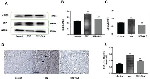 Figure 3 Effect of Ganoderma lucidum spore (GLS) on brain natriuretic peptide (BNP, molecular weight is 37 kDa) and α-smooth muscle actin (α-SMA, molecular weight is 42 kDa) expression in myocardial tissues. Representative Western blot images (A) and quantitative analysis for expression of BNP (B) and α-SMA (C) in the myocardial tissues of rats from different groups. Representative immunohistochemistry micrographs for BNP expression in cardiac tissues of rats from different groups (D). Strong BNP immunostaining was observed in most of the myocardial cells in the STZ group, compared with the control and STZ +GLS groups (see the arrow-indicated area). Statistical analysis of immunohistochemistry results for cardiac BNP expression (E). Values represent mean ± SE; n = 3 in each group. **, p < 0.01 versus the control group and ##, p < 0.01 versus the STZ group using Tukey’s test. Control: 5 mL/kg saline (p.o.); Diabetic: 50 mg/kg streptozotocin (i.p.) and 5 mL/kg saline (p.o.); STZ +GLS: 50 mg/kg streptozotocin (i.p.) and 300 mg/kg GLS (p.o.).