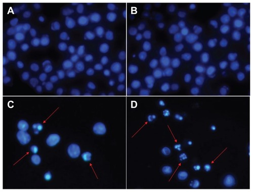 Figure 6 Nuclear morphologic changes of K562 leukemia cells after different treatments for 48 hours: (A) untreated cells as control, (B) titanium dioxide nanoparticles, (C) daunorubicin alone, and (D) daunorubicin-titanium dioxide nanocomposites. Concentrations of daunorubicin and titanium dioxide nanoparticles are 0.5 μg/mL and 10 μg/mL, respectively.Notes: Magnification: ×400. Arrows indicate cells with apoptotic nuclear condensation and fragmentation.