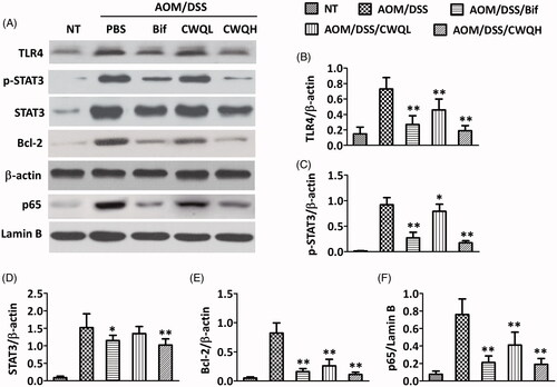 Figure 4. Chang-wei-qing decreased TLR4/NF-κB and STAT3 signalling genes in CAC mouse model. (A) Genes levels in colonic tissue were measured by western blotting. (B–E) Semi-quantitative analysis of TLR4, p-STAT3, STAT3 and Bcl-2 proteins expression compared with β-actin. (F) Semi-quantitative analysis of p65 protein expression compared with lamin B. Data are means ± SD. Experiments were repeated for three times. *p < 0.05, **p < 0.01 vs. AOM/DSS group.