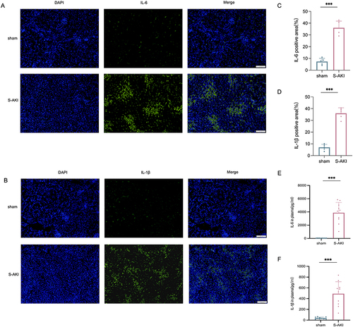 Figure 3 The hub genes expression in S-AKI. (A and B) The immunofluorescence of hub genes of S-AKI group vs sham group. Images, × 100; original scale bar, 200 μm. (C and D) Quantification was represented in panel (n=10). (E and F) The concentrations of IL-6 and IL-1β in serum (n=10). Data were expressed as mean ± standard deviation. Difference between S-AKI group and sham group was made using unpaired Student’s t-test for normally distributed data. ***p<0.001.