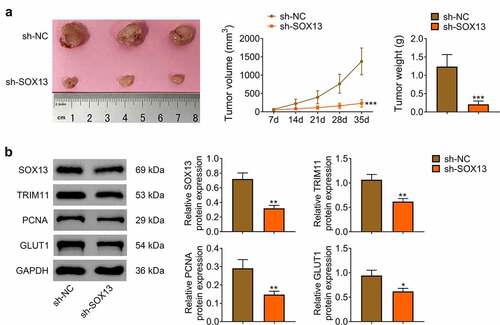 Figure 5. SOX13 knockdown inhibited tumorigenicity of breast cancer cell in vivo. (a) The volume and weight of tumor (***p < 0.001). (b) The protein level of SOX13, TRIM11, PCNA and GLUT1 detected by western blot. Each bar is regarded as the mean ±SD of 3 independent experiments (**p < 0.01, *p < 0.05). ***p < 0.001, **p < 0.01, *p < 0.05 versus sh-NC group.