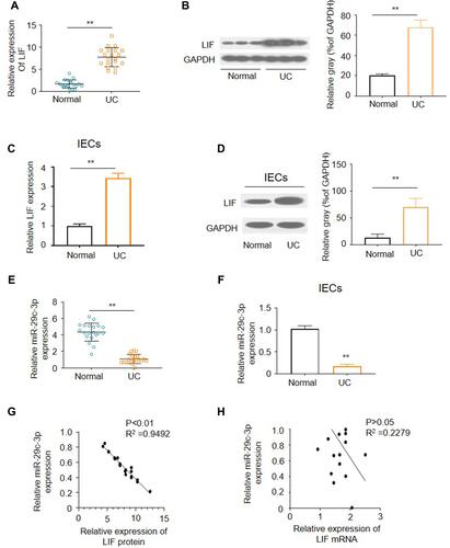 Figure 1 The expression of miR-29c-3p and LIF in UC tissues and IECs. (A) The mRNA levels of LIF in UC and normal tissues. (B) Representative Western blots and densitometric quantitative analysis of LIF proteins levels in UC and normal tissues. (C) The mRNA levels of LIF in primary IECs of UC and normal colon. (D) Representative Western blots and densitometric quantitative analysis of LIF protein levels in IECs of UC and normal colon. (E) The expression of miR-29c-3p in UC and normal tissues. (F) The expression of miR-29c-3p in primary IECs of UC and normal colon. (G) Pearson’s correlation analysis of the expression levels of miR-29c-3p and LIF protein. (H) Pearson’s correlation analysis of the expression levels of miR-29c-3p and LIF mRNA. **P<0.01 versus normal group.