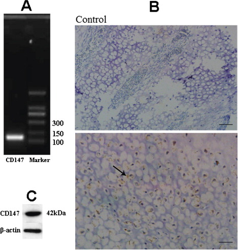 Figure 2. 2a: Total RNA was extracted from chicken tibiotarsal growth plate and subjected to RT-PCR using specific primers against CD147 and then run on agarose gel. 2b: Immunohistochemistry of CD147 in the tibiotarsal growth plate of a broiler chicken; after fixing in 4% paraformaldehyde, decalcification in 10% ethylenediamine tetraacetic acid, dehydration in ethanol, clearing in xylene and embedding in paraffin, the sections (4 to 5 µm) were stained with rabbit or goat antibodies followed by saturation with horseradish peroxidase-linked secondary antibodies. Primary antibodies were omitted from the control samples (above; bar = 50 µm), while positive samples (below; bar = 20 µm) were identified as the presence of brown granules. Arrow represents the positive CD147. 2c: For western blotting, total cellular protein was separated and blotted with CD147 antibodies.