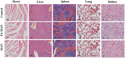 Figure 6. H&E staining iamges of the major organs (heart, liver, spleen, lung, kidney) from different groups. Mice were intravenously injected with 150 µL physiological saline of FA-MAN/MAN nanospheres (10 mg Fe/ml) and dissected after 30 days of post-injection (Scale bar: 50 µm).