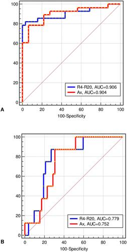 Figure 3 Analysis of receiver operator characteristic (ROC) for the two best parameters observed in predicting exercise tolerance in COPD. Results for the analysis are based on the ADL – Glittre test (A) and Handgrip analysis (B).
